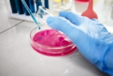 How Can Western Blot Gel Electrophoresis Help Resolve Validation Gaps?